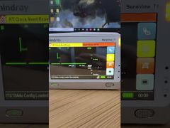 কেন সামনের কভার সহ Mindray BeneView T1 রোগী মনিটর LCD স্ক্রীন বেছে নিন দেখুন