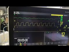 Mindray AG মডিউল AG এবং O2 মডিউল MMS মডিউল PN 115-023943-00 ডেমো দেখুন