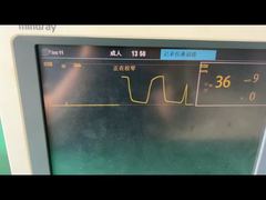 আরও কাছ থেকে দেখুন: 9200-10-10530 প্রাপ্তবয়স্ক পেডিয়াট্রিক অ্যানেস্থেসিয়া গ্যাস মডিউলের জন্য মাইন্ড্রে ওয়াটার ট্র্যাপ